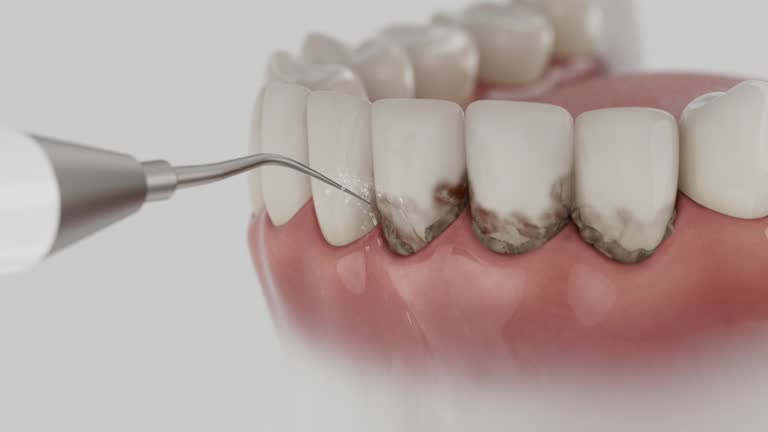 Trusted Teeth Cleaning And Checkup service in Big Lake, MN - Dentist Open Now